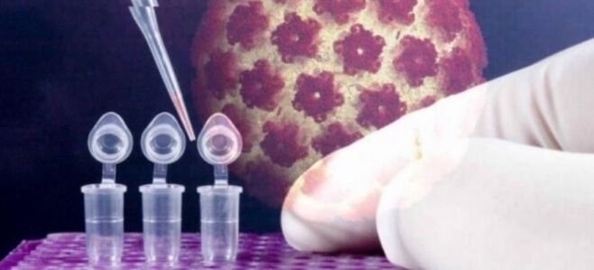 Diagnostica HPV utilizzando il test digene